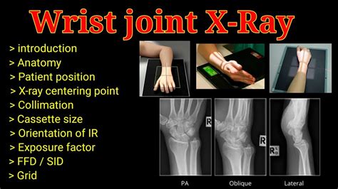 wrist ap|pa vs ap wrist xray.